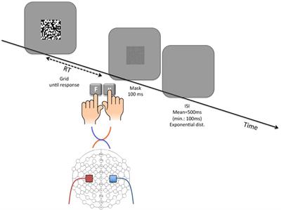 Differential Bilateral Primary Motor Cortex tDCS Fails to Modulate Choice Bias and Readiness in Perceptual Decision Making